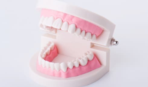 歯の状態によっては矯正期間が長くなることがある
